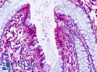 Human, Colon: Formalin-Fixed Paraffin-Embedded (FFPE)