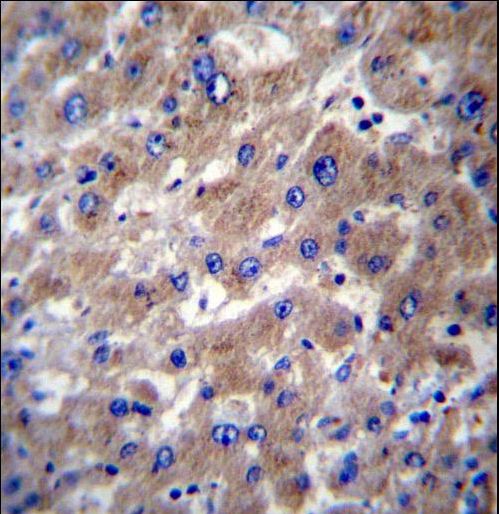 SLMO2 Antibody immunohistochemistry of formalin-fixed and paraffin-embedded human liver tissue followed by peroxidase-conjugated secondary antibody and DAB staining.