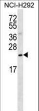 SLMO2 Antibody western blot of NCI-H292 cell line lysates (35 ug/lane). The SLMO2 antibody detected the SLMO2 protein (arrow).