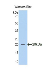Western blot of recombinant ALK1 / SLPI.