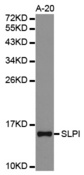 Western blot analysis of extracts of A-20 cell lines, using SLPI antibody.