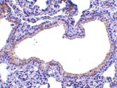Immunohistochemistry of formalin-fixed, paraffin-embedded mouse lung stained with Rabbit anti-Human SLP1 following heat mediated antigen retrieval using sodium citrate buffer (pH6.0)