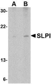 Western blot of whole cell lysate from Daudi, Burkitt's lymphoma derived cels probed with Rabbit anti-Human SLP1 probed with Rabbit anti-Human SLP1 at 1(A) and 2(B) ug/ml
