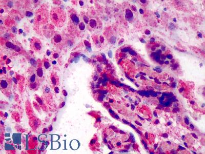 Anti-SLPI antibody IHC staining of human placenta. Immunohistochemistry of formalin-fixed, paraffin-embedded tissue after heat-induced antigen retrieval. Antibody LS-B2174 concentration 2.5 ug/ml.