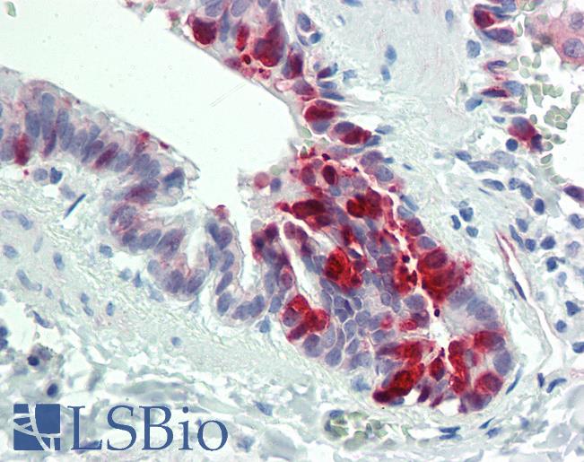 Anti-ALK1 / SLPI antibody IHC staining of human lung, respiratory epithelium. Immunohistochemistry of formalin-fixed, paraffin-embedded tissue after heat-induced antigen retrieval. Antibody LS-B11140 concentration 10 ug/ml.