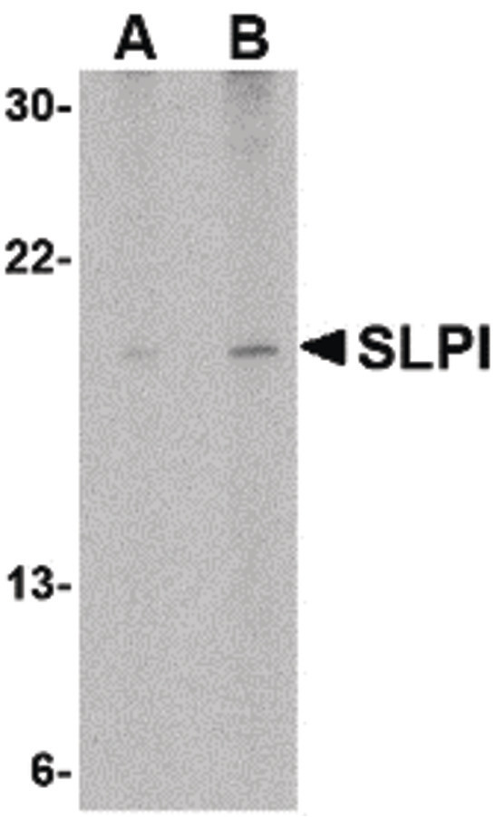 Western blot of SLPI in Daudi cell lysate with SLPI antibody at (A) 1 and (B) 2 ug/ml.