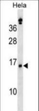 SLPI Antibody western blot of HeLa cell line lysates (35 ug/lane). The SLPI antibody detected the SLPI protein (arrow).