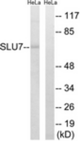 Western blot of extracts from HeLa cells, using SLU7 Antibody. The lane on the right is treated with the synthesized peptide.
