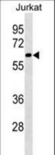 SLU7 Antibody western blot of Jurkat cell line lysates (35 ug/lane). The SLU7 Antibody detected the SLU7 protein (arrow).