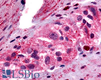 Anti-PTGER4 / EP4 antibody LS-A3898 IHC of human colon, ganglion. Immunohistochemistry of formalin-fixed, paraffin-embedded tissue after heat-induced antigen retrieval.