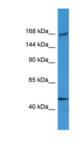 SLX4 antibody LS-C135640 Western blot of ACHN lysate.