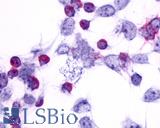 Anti-PTGER4 / EP4 antibody LS-A3898 immunocytochemistry (ICC) staining of HEK293 human embryonic kidney cells transfected with PTGER4 / EP4.