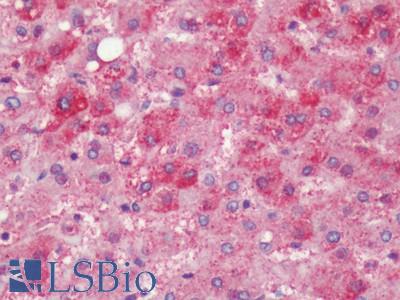 Human, Liver: Formalin-Fixed Paraffin-Embedded (FFPE)
