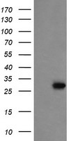 HEK293T cells were transfected with the pCMV6-ENTRY control (Left lane) or pCMV6-ENTRY PROSC (Right lane) cDNA for 48 hrs and lysed. Equivalent amounts of cell lysates (5 ug per lane) were separated by SDS-PAGE and immunoblotted with anti-PROSC.