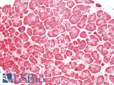 Human, Pancreas: Formalin-Fixed Paraffin-Embedded (FFPE)