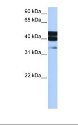 MCF7 cell lysate. Antibody concentration: 0.5 ug/ml. Gel concentration: 12%.