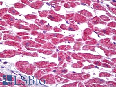 Anti-PTGES2 antibody IHC of human heart. Immunohistochemistry of formalin-fixed, paraffin-embedded tissue after heat-induced antigen retrieval. Antibody LS-B6962 concentration 5 ug/ml.