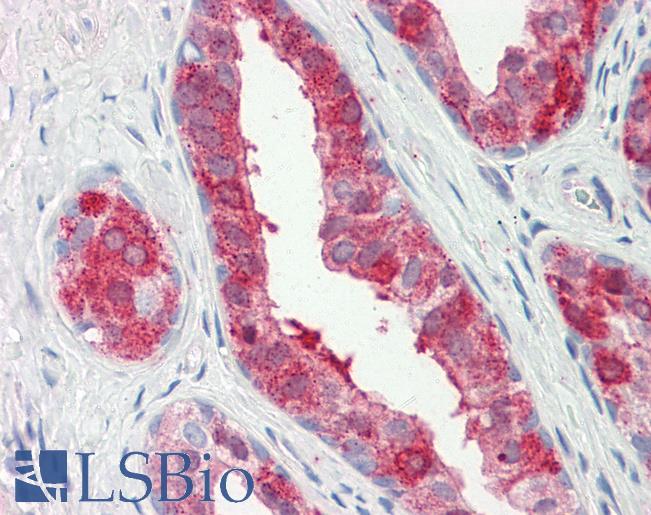 Human Prostate: Formalin-Fixed, Paraffin-Embedded (FFPE)