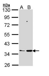 Sample (30 ug of whole cell lysate). A: 293T. B: Molt-4. 10% SDS PAGE. PTGES2 antibody diluted at 1:1000.