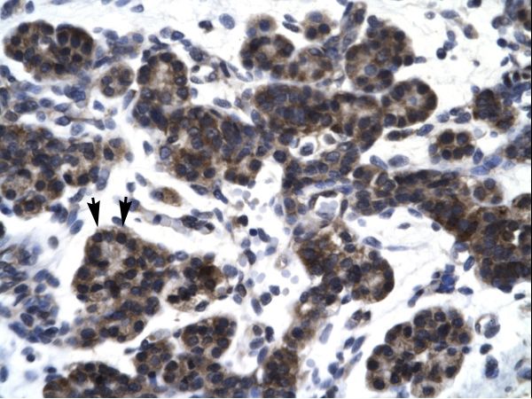 SMAD3 antibody LS-C31014 was used in IHC to stain formalin-fixed, paraffin-embedded human pancreas.