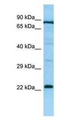 PTGES2 antibody Western Blot of Jurkat.