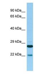 PTGES2 antibody Western Blot of 721_B.