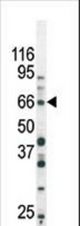 The anti-Phospho-SMAD3-S213 antibody is used in Western blot to detect Phospho-SMAD3-S213 in Ramos tissue lysate