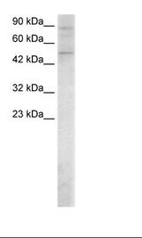 Raji Cell Lysate