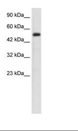 Jurkat Cell Lysate
