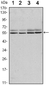 Western blot using SMAD6 mouse monoclonal antibody against A431 (1), A431 (2), HeLa (3) and Jurkat (4) cell lysate.