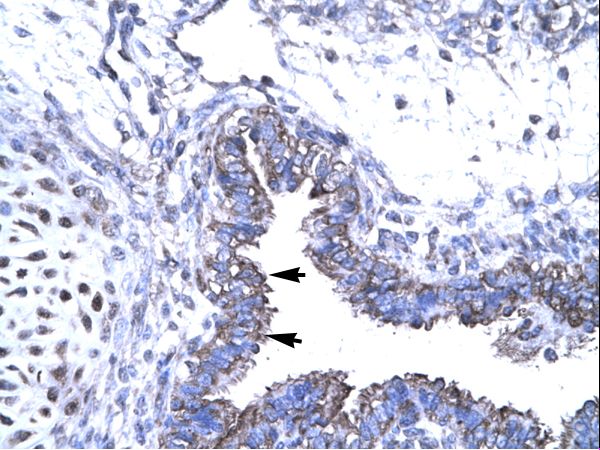 SMAD6 antibody LS-C31183 was used in IHC to stain formalin-fixed, paraffin-embedded human lung.