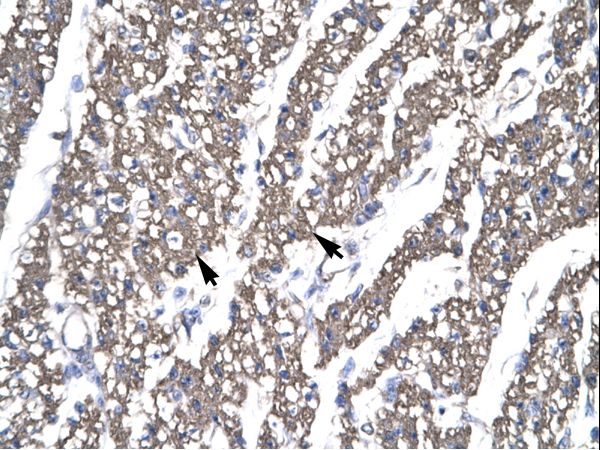 SMAD6 antibody LS-C31183 was used in IHC to stain formalin-fixed, paraffin-embedded human heart.