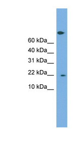 PTGES3 antibody LS-C116787 Western blot of COLO205 cell lysate.