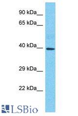 SMAD6 antibody Western Blot of Thymus Tumor. Antibody dilution: 1 ug/ml.