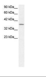 Fetal Lung Lysate