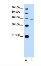 Lane A: Marker. Lane B: Jurkat cell lysate. Antibody concentration: 1.25 ug/ml. Gel concentration: 12%.