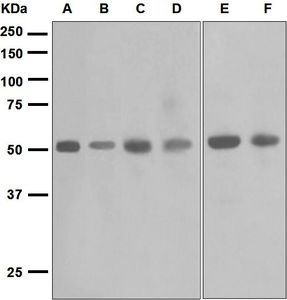 Western blot analysis on (A) uterus, (B) ovary cancer, (C) fetal lung, (D) human skeletal muscle, (E) human kidney, and (F) human heart lysates using anti-Smad7 antibody.