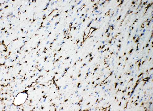 SMAD7 antibody. IHC(P): Rat Brain Tissue.