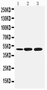 WB of SMAD7 antibody. Lane 1: Rat Brain Tissue Lysate. Lane 2: A549 Cell Lysate. Lane 3: HELA Cell Lysate.