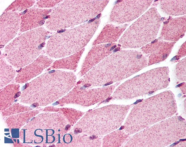 Anti-SMAD7 antibody IHC of human skeletal muscle. Immunohistochemistry of formalin-fixed, paraffin-embedded tissue after heat-induced antigen retrieval. Antibody LS-B120 concentration 10 ug/ml.