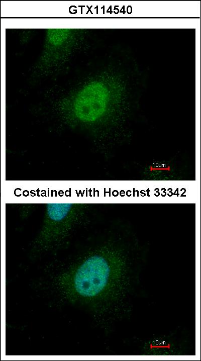 Immunofluorescence of paraformaldehyde-fixed HeLa using SMAD9 antibody at 1:500 dilution.