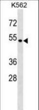 SMAP1 Antibody western blot of K562 cell line lysates (35 ug/lane). The SMAP1 antibody detected the SMAP1 protein (arrow).