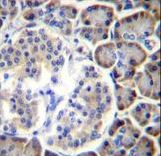 SMAP2 Antibody immunohistochemistry of formalin-fixed and paraffin-embedded human pancreas tissue followed by peroxidase-conjugated secondary antibody and DAB staining.