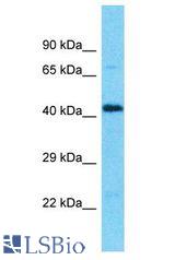 SMAP2 antibody Western Blot of U937. Antibody dilution: 1 ug/ml.