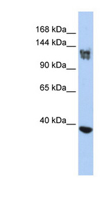 SMARCA1 antibody LS-C109921 Western blot of Jurkat lysate.