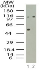 Western blot of SNF2L1 in mouse brain lysate in the 1) absence and 2) presence of immunizing peptide using LS-C148902 at 1:2000 dilution.