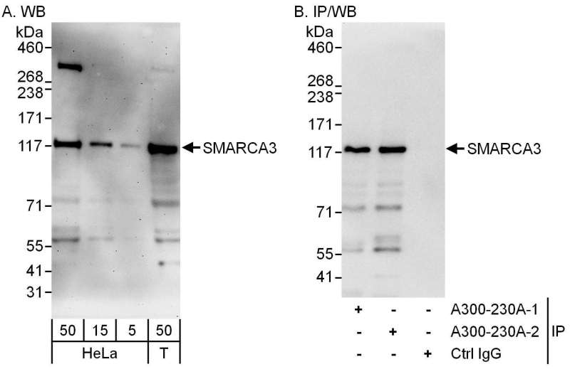 Detection of Human SMARCA3 by Western Blot and Immunoprecipitation. Samples: Whole cell lysate from HeLa (5, 15 and 50 ug for WB; 1 mg for IP, 20% of IP loaded) and 293T (T; 50 ug) cells. Antibodies: Affinity purified rabbit anti-SMARCA3 antibody used for WB at 0.04 ug/ml (A) and 0.4 ug/ml (B) and used for IP at 6 ug/mg lysate. SMARCA3 was also immunoprecipitated by a previous lot of this antibody. Detection: Chemiluminescence with exposure times of 3 minutes (A) and 10 seconds (B).