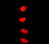 Immunofluorescent staining of HeLa cells using anti-BRG1 antibody.