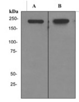 Western blot analysis on A) K562 and B) Molt-4 cell lysates using anti-BRG1 antibody.