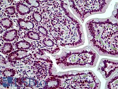 Anti-SMARCA4 / BRG1 antibody IHC of human small intestine. Immunohistochemistry of formalin-fixed, paraffin-embedded tissue after heat-induced antigen retrieval. Antibody LS-B5107 concentration 3.75 ug/ml.